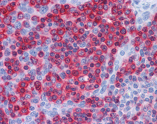 PREP Antibody in Immunohistochemistry (Paraffin) (IHC (P))