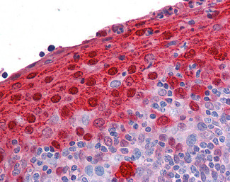 S100A7 Antibody in Immunohistochemistry (Paraffin) (IHC (P))