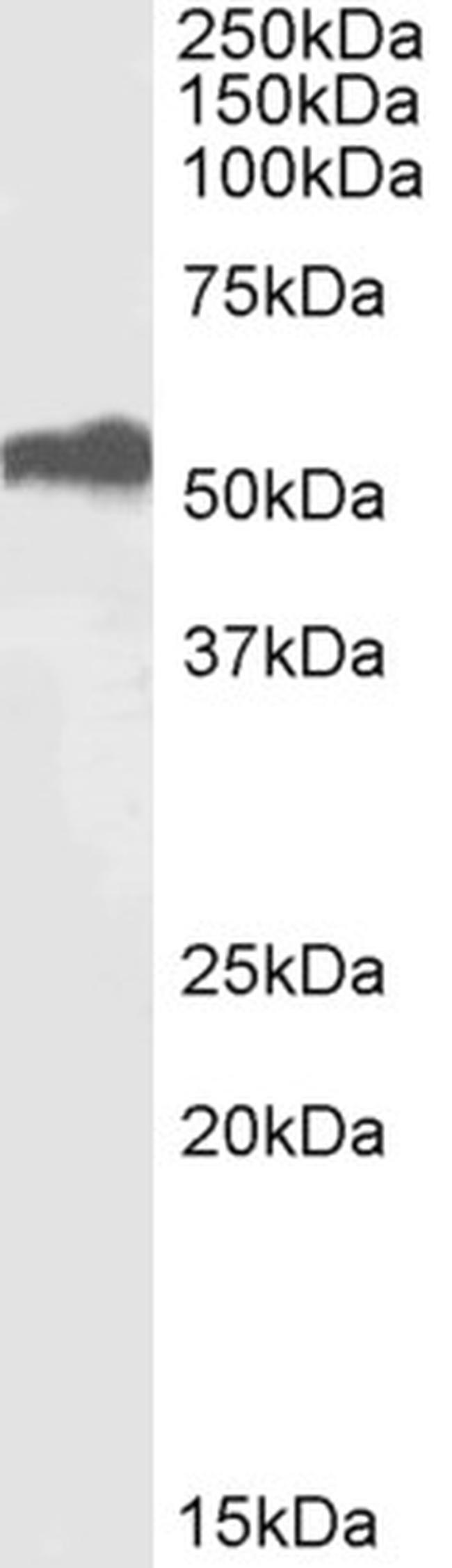 ETV4 Antibody in Western Blot (WB)