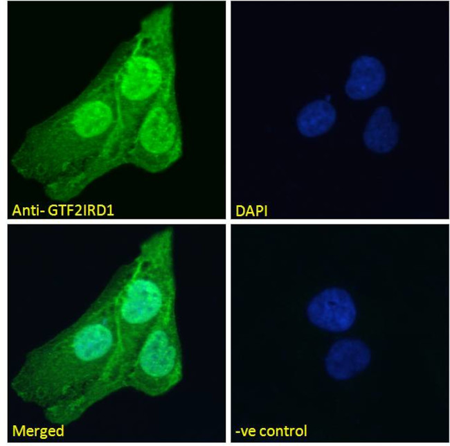 GTF2IRD1 Antibody in Immunocytochemistry (ICC/IF)