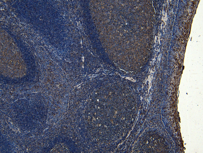 SOX2 Antibody in Immunohistochemistry (Paraffin) (IHC (P))