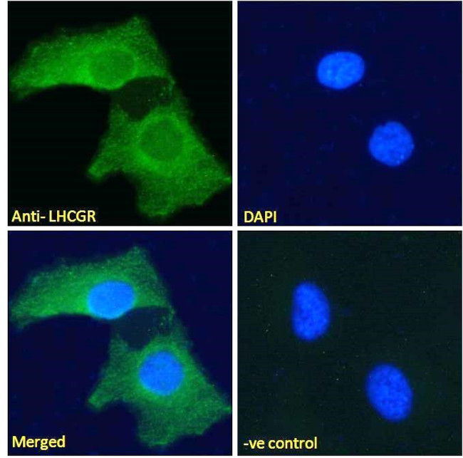 LHR Antibody in Immunocytochemistry (ICC/IF)
