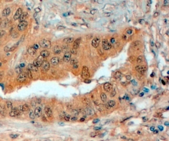 SEMA3E Antibody in Immunohistochemistry (Paraffin) (IHC (P))