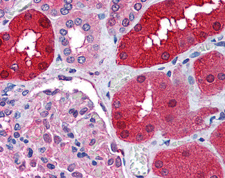 RNF213 Antibody in Immunohistochemistry (Paraffin) (IHC (P))