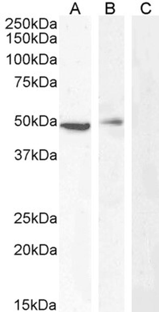 Carabin Antibody in Western Blot (WB)