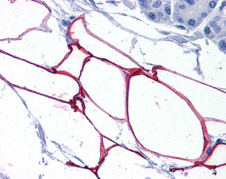 PLIN4 Antibody in Immunohistochemistry (Paraffin) (IHC (P))