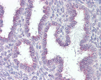 RER1 Antibody in Immunohistochemistry (Paraffin) (IHC (P))