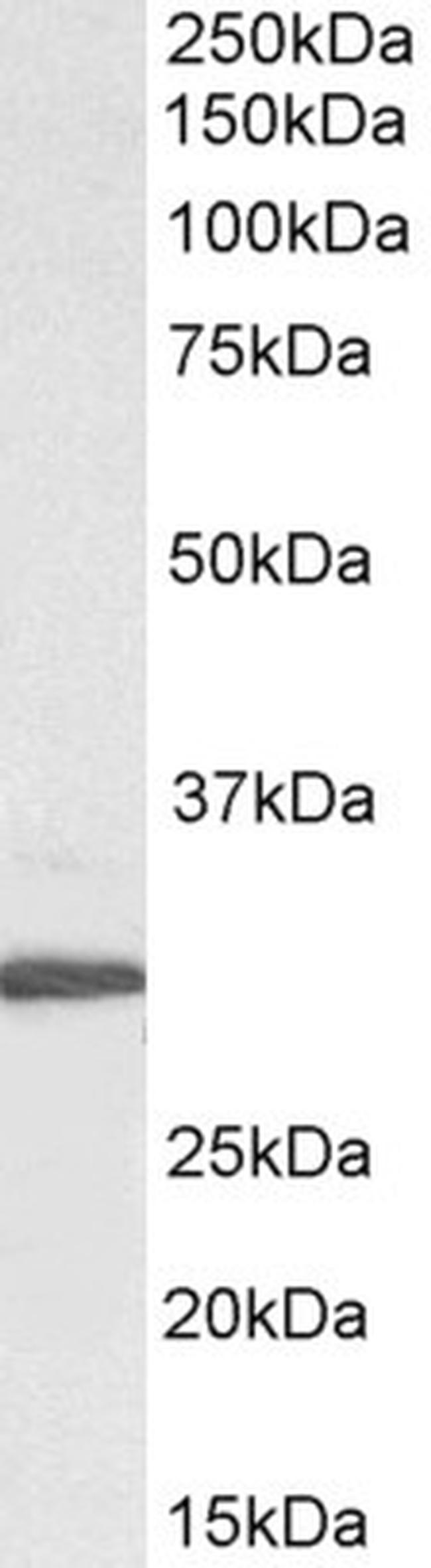 RPL8 Antibody in Western Blot (WB)