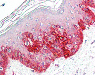 ATG16L1 Antibody in Immunohistochemistry (Paraffin) (IHC (P))
