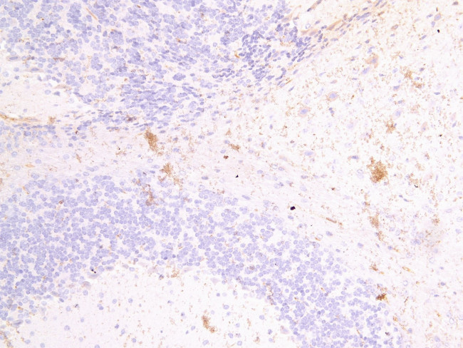 FSCN2 Antibody in Immunohistochemistry (Paraffin) (IHC (P))