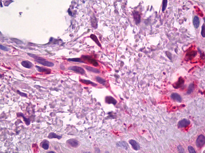 Factor XIII A Antibody in Immunohistochemistry (Paraffin) (IHC (P))