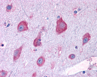 RPL22 Antibody in Immunohistochemistry (Paraffin) (IHC (P))