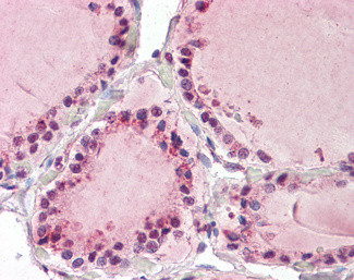 TAB3 Antibody in Immunohistochemistry (Paraffin) (IHC (P))