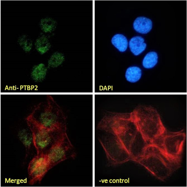 PTBP2 Antibody in Immunocytochemistry (ICC/IF)