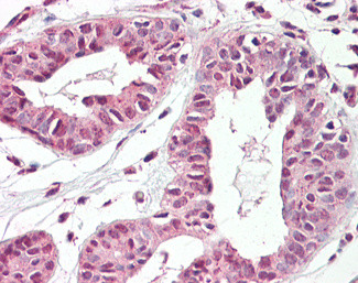 TREX2 Antibody in Immunohistochemistry (Paraffin) (IHC (P))