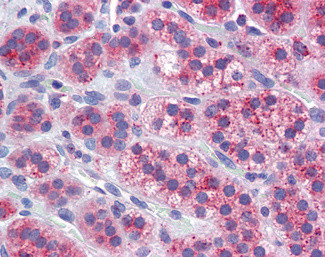 MFN1 Antibody in Immunohistochemistry (Paraffin) (IHC (P))