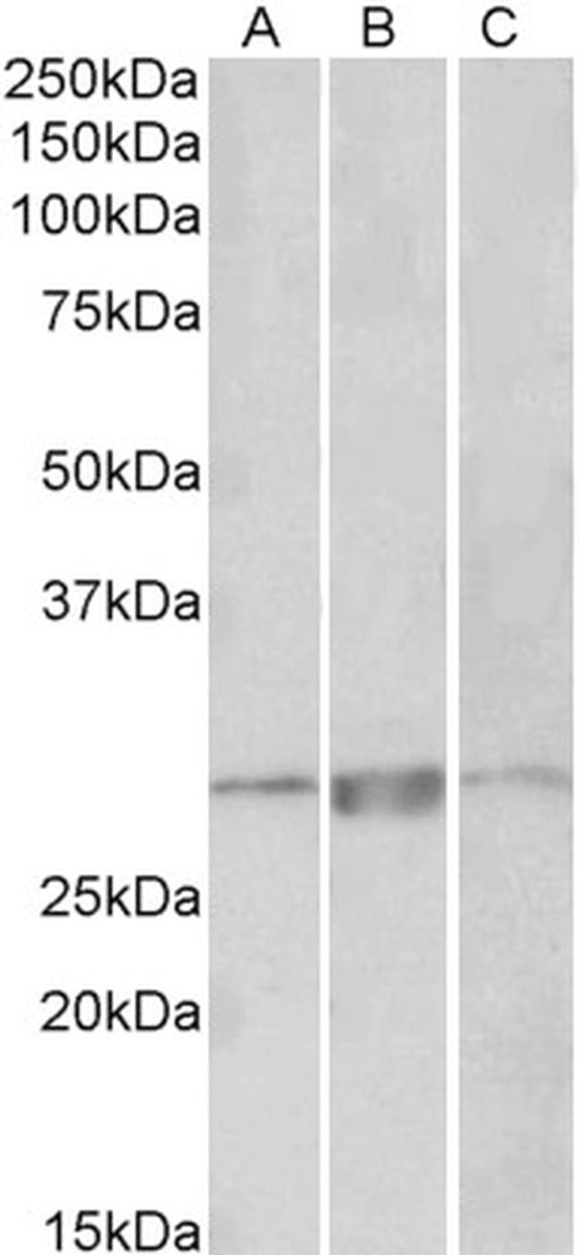 PRRX1 Antibody in Western Blot (WB)