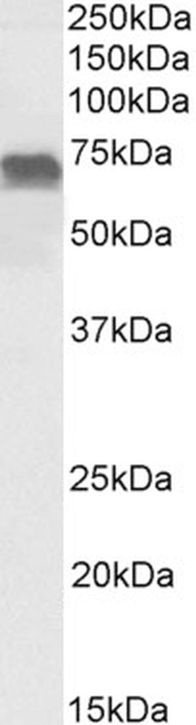 PRICKLE3 Antibody in Western Blot (WB)