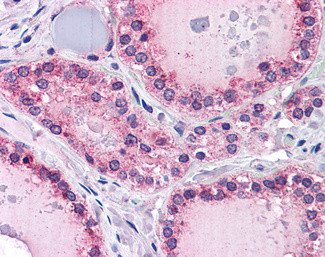 PTPRM Antibody in Immunohistochemistry (Paraffin) (IHC (P))