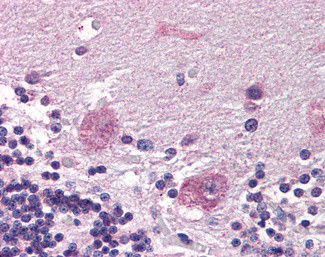 PPP2R3A Antibody in Immunohistochemistry (Paraffin) (IHC (P))
