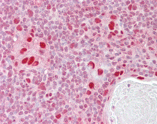MSH5 Antibody in Immunohistochemistry (Paraffin) (IHC (P))
