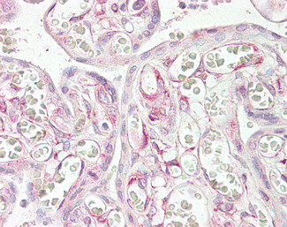RARRES3 Antibody in Immunohistochemistry (Paraffin) (IHC (P))