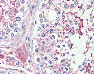 HRASLS Antibody in Immunohistochemistry (Paraffin) (IHC (P))