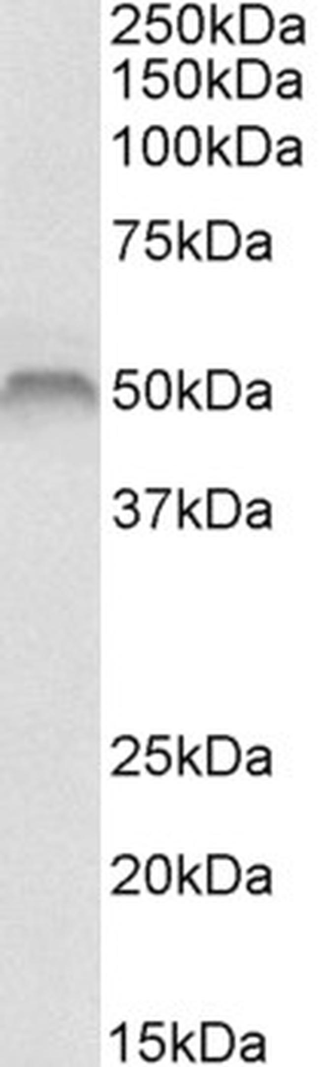 Fascin Antibody in Western Blot (WB)