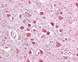 C/EBP gamma Antibody in Immunohistochemistry (Paraffin) (IHC (P))