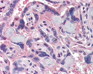 SRC3 Antibody in Immunohistochemistry (Paraffin) (IHC (P))