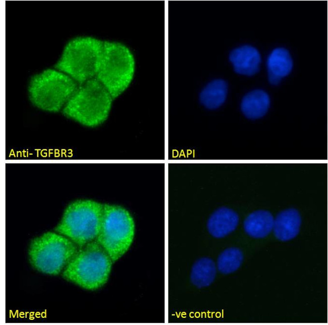 TGFBR3 Antibody in Immunocytochemistry (ICC/IF)