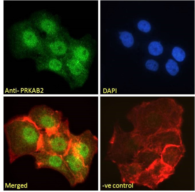 AMPK beta-2 Antibody in Immunocytochemistry (ICC/IF)