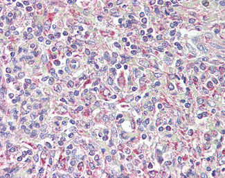 TRIB1 Antibody in Immunohistochemistry (Paraffin) (IHC (P))