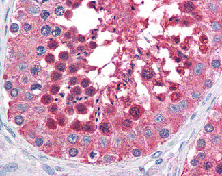 HSPA4L Antibody in Immunohistochemistry (Paraffin) (IHC (P))