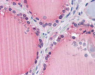FZD9 Antibody in Immunohistochemistry (Paraffin) (IHC (P))
