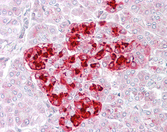 IGFBP7 Antibody in Immunohistochemistry (Paraffin) (IHC (P))