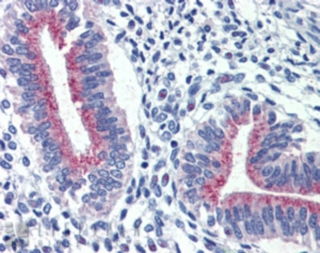 SERPINA6 Antibody in Immunohistochemistry (Paraffin) (IHC (P))