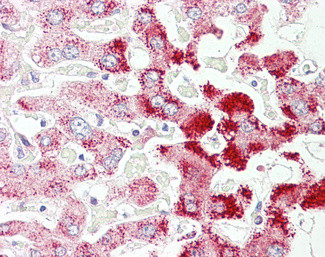 SCP2 Antibody in Immunohistochemistry (Paraffin) (IHC (P))
