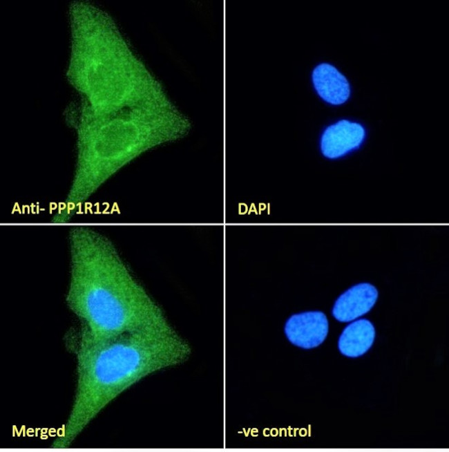 MYPT1 Antibody in Immunocytochemistry (ICC/IF)