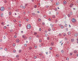 HRASLS2 Antibody in Immunohistochemistry (Paraffin) (IHC (P))