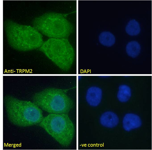 TRPM2 Antibody in Immunocytochemistry (ICC/IF)