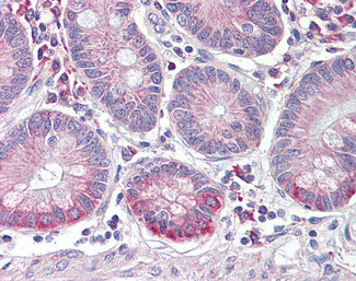 SLC10A2 Antibody in Immunohistochemistry (Paraffin) (IHC (P))