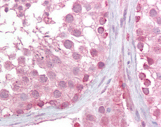 LMX1B Antibody in Immunohistochemistry (Paraffin) (IHC (P))
