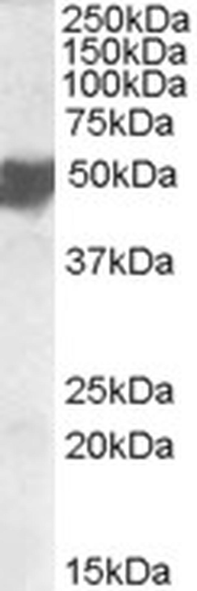 ASAM Antibody in Western Blot (WB)