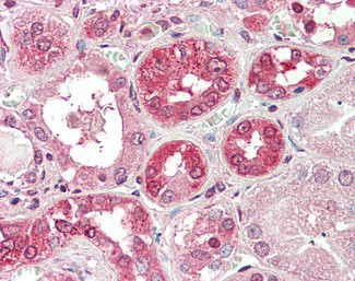 COG8 Antibody in Immunohistochemistry (Paraffin) (IHC (P))