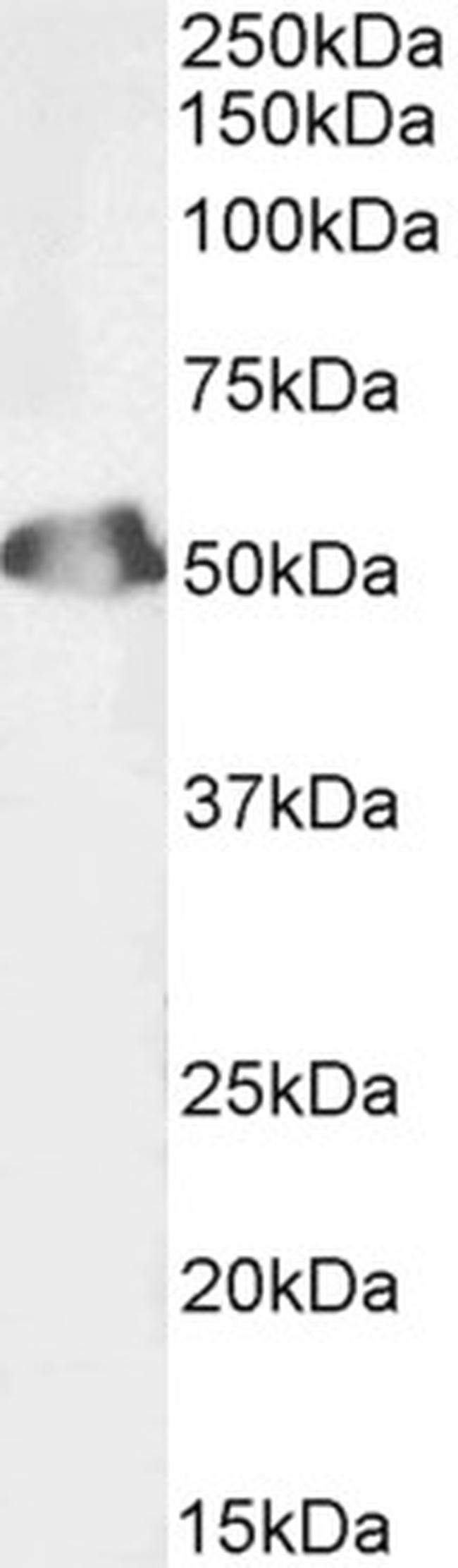 SEPT6 Antibody in Western Blot (WB)