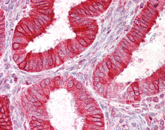 SCNN1D Antibody in Immunohistochemistry (Paraffin) (IHC (P))