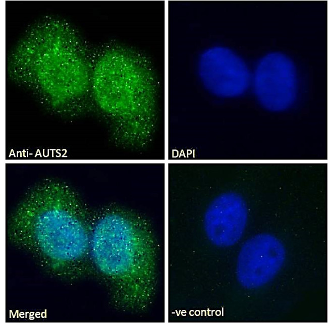 AUTS2 Antibody in Immunocytochemistry (ICC/IF)