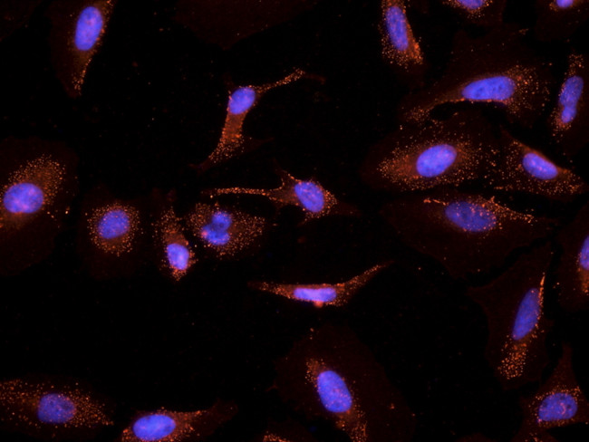 CYP26A1 Antibody in Immunocytochemistry (ICC/IF)