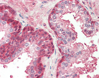 RCBTB2 Antibody in Immunohistochemistry (Paraffin) (IHC (P))